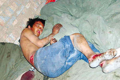 安徽寿县窑厂被指用智障人员充当苦力不发工钱-黑砖窑,虐工,苦力-东北