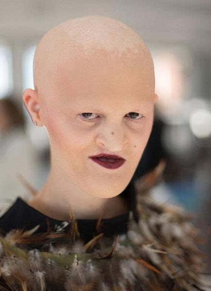 美国秃顶嫩模靠著一口无牙,在模特界闯出一片天